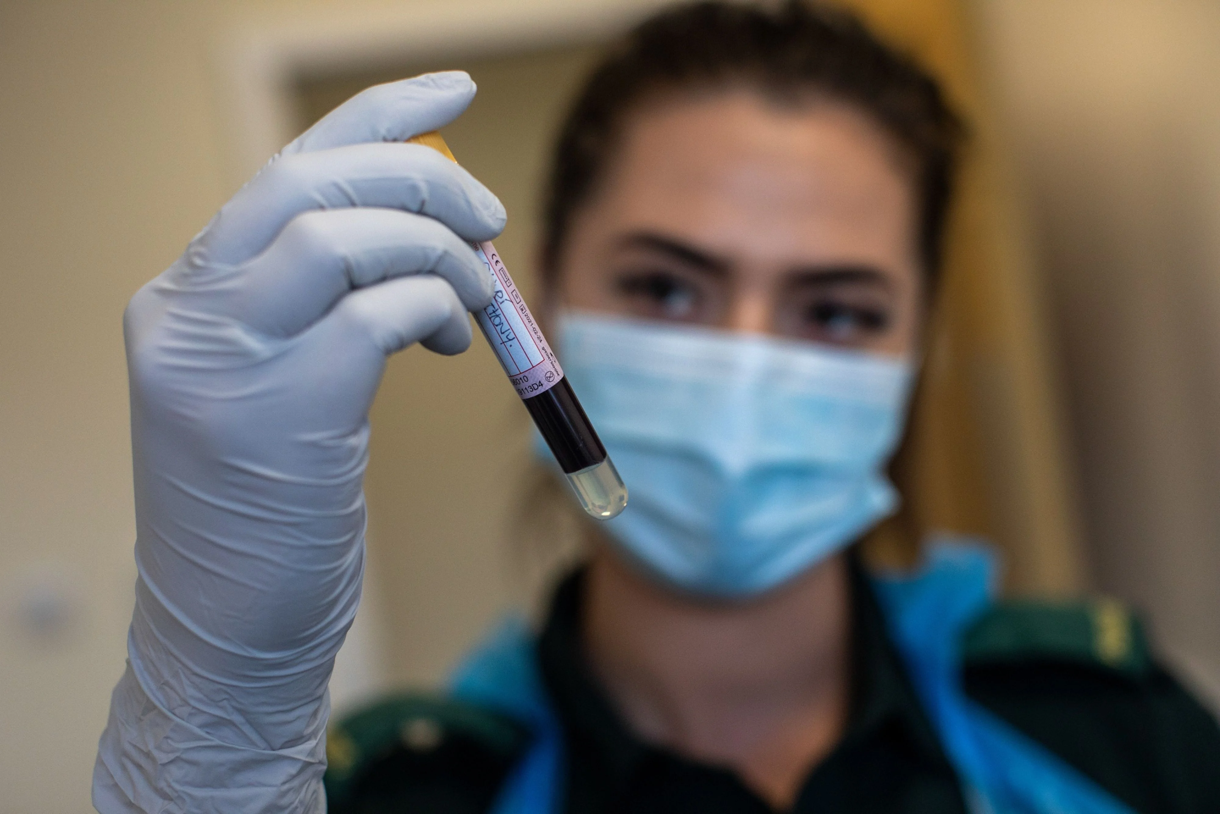 Covid Antibodies Fade Rapidly Raising Risk Of Lost Immunity