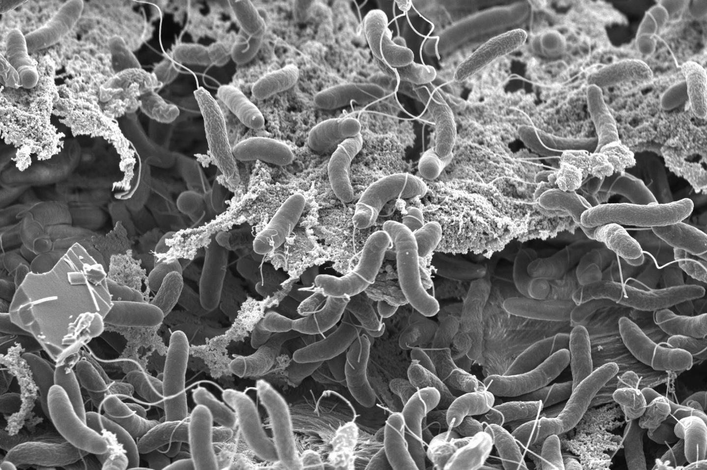 Cholera outbreak declared in Bacolod
