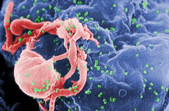 Caloocan conducts seminar on HIV, AIDS awareness