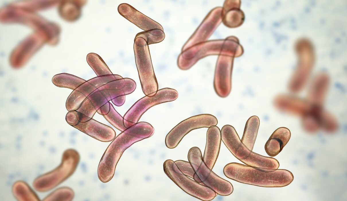Tacloban ‘cholera’ cases rise