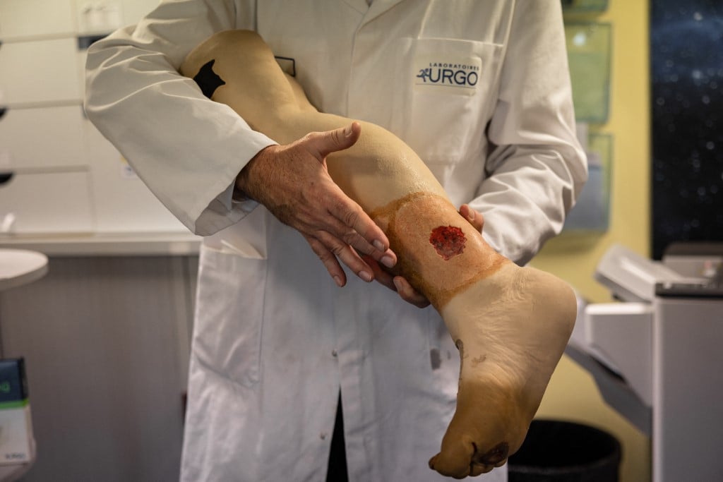 Dressing ‘revolution’ seeks artificial skin for burn victims