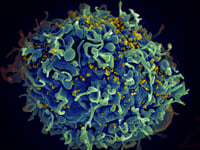 QC boosts drive vs HIV, AIDS