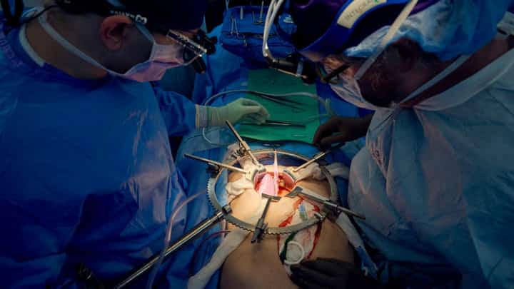 FILE PHOTO: This 14 July 2023, image released by NYU Langone Health in New York, shows a team of surgeons transplanting a pig kidney. US surgeons who transplanted a genetically modified pig kidney into a brain-dead patient announced 14 September 2023 they had ended their experiment after a record-breaking 61 days. (Photo by Joe Carrotta / NYU Langone Health / AFP)