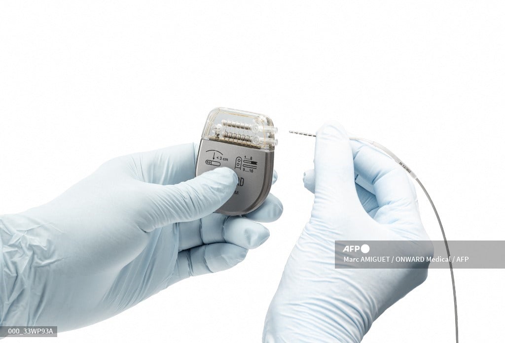 Brain implants could restore paralyzed patients’ arm movements