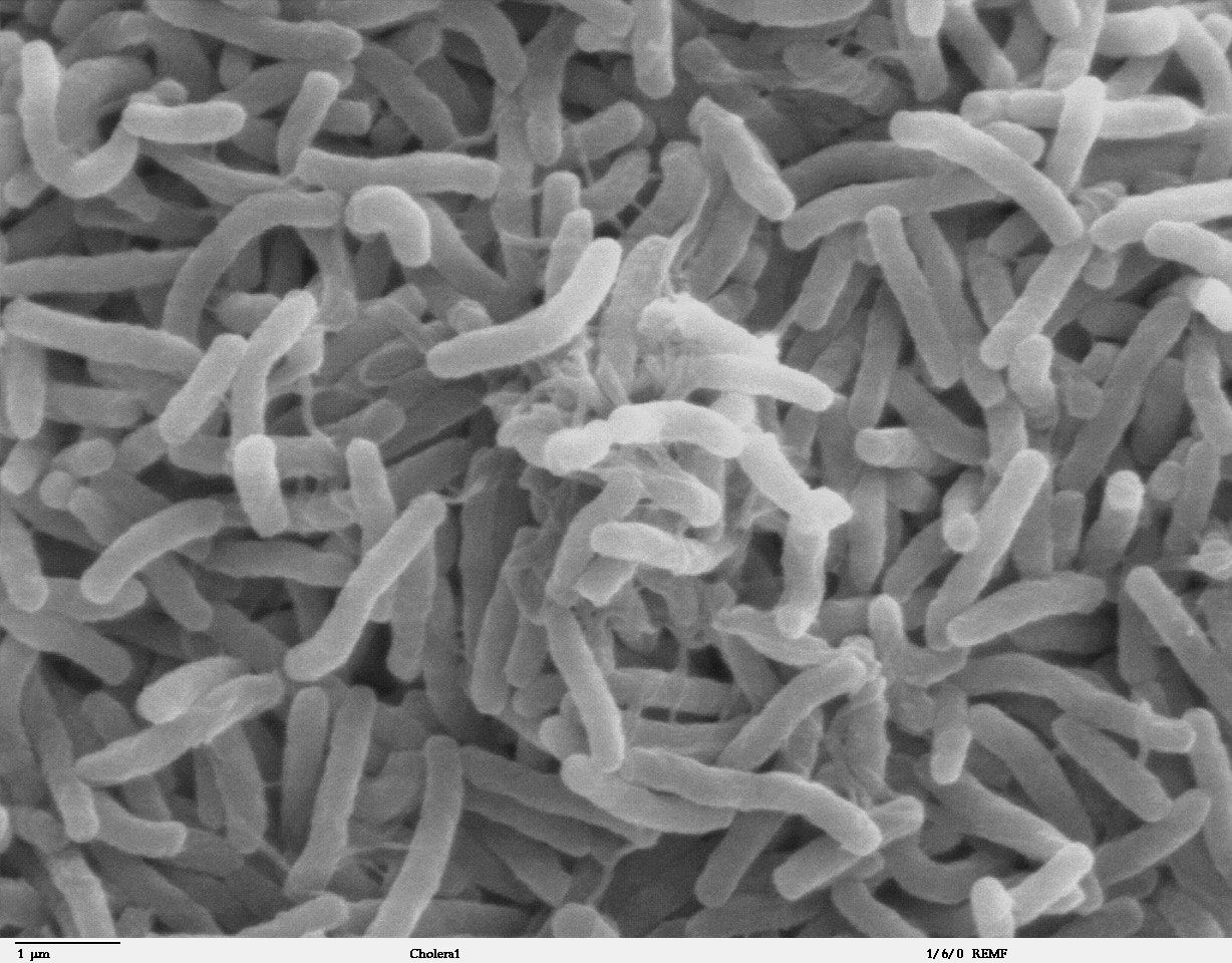 Eastern Visayas cholera cases rise