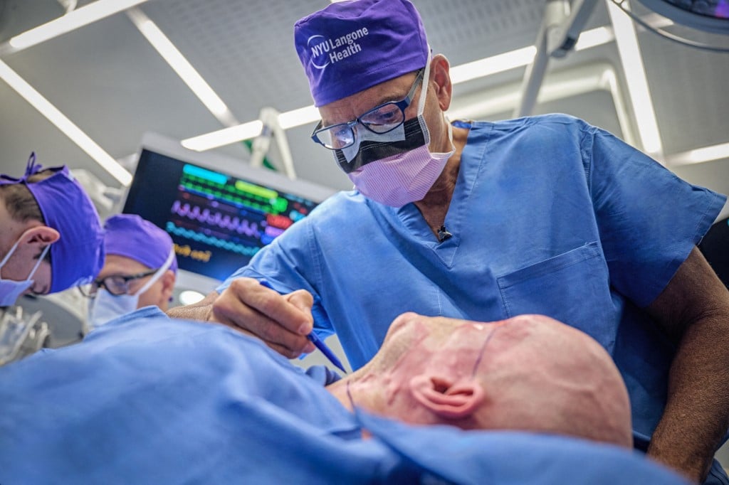 US surgeons perform world’s first whole eye transplant