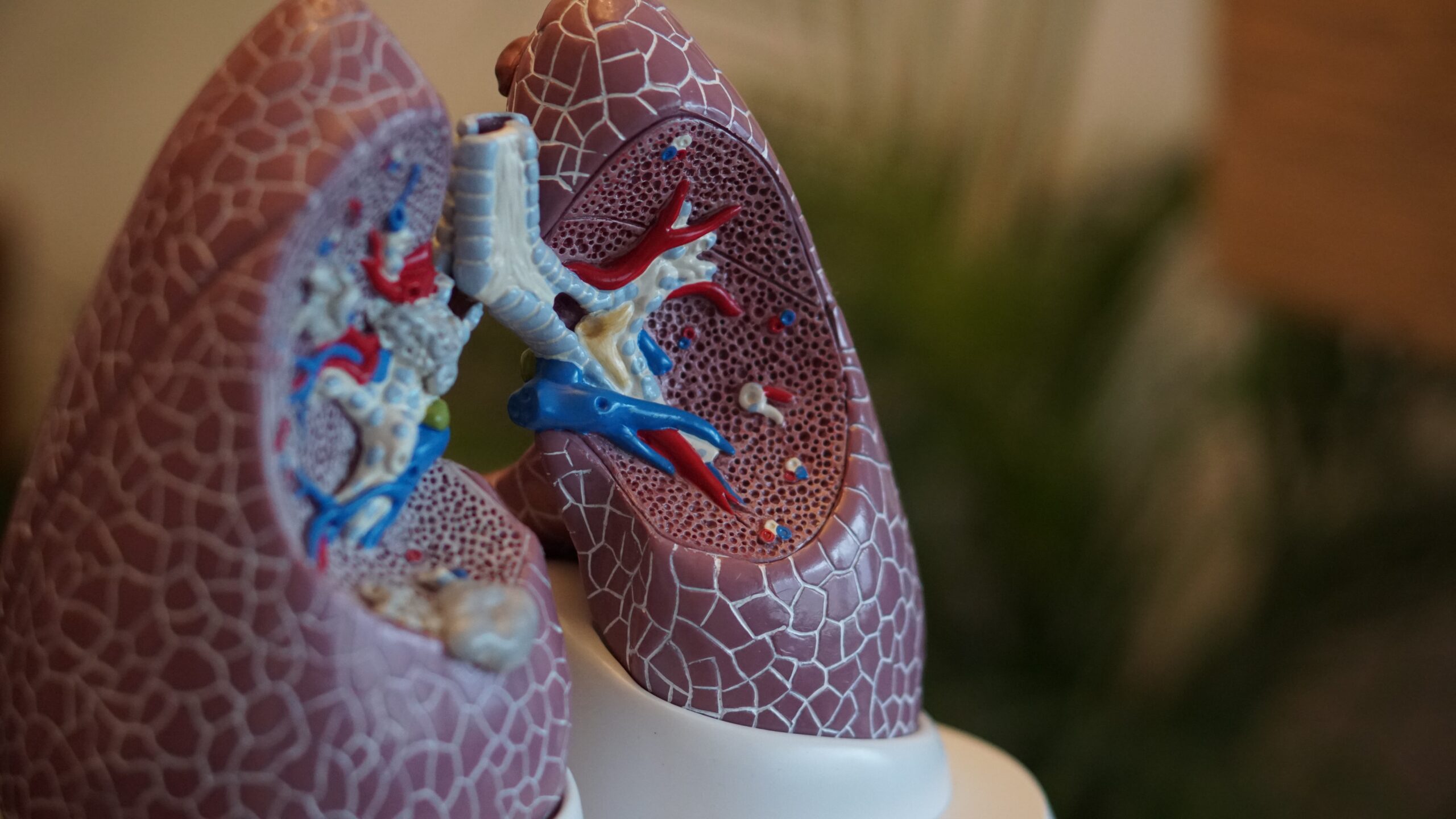 Phl urged to take decisive action vs. TB
