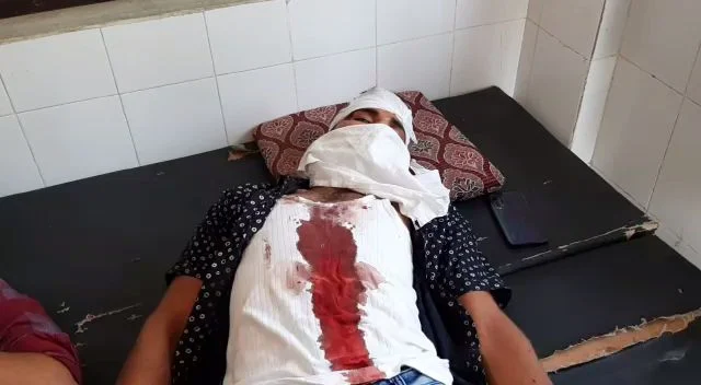 Coronavirus in Rajasthan: Five cops injured in attack in Kasai Mohalla area in Tonk during curfew, hospitalised