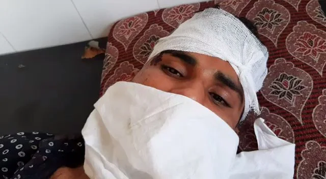 Coronavirus in Rajasthan: Five cops injured in attack in Kasai Mohalla area in Tonk during curfew, hospitalised