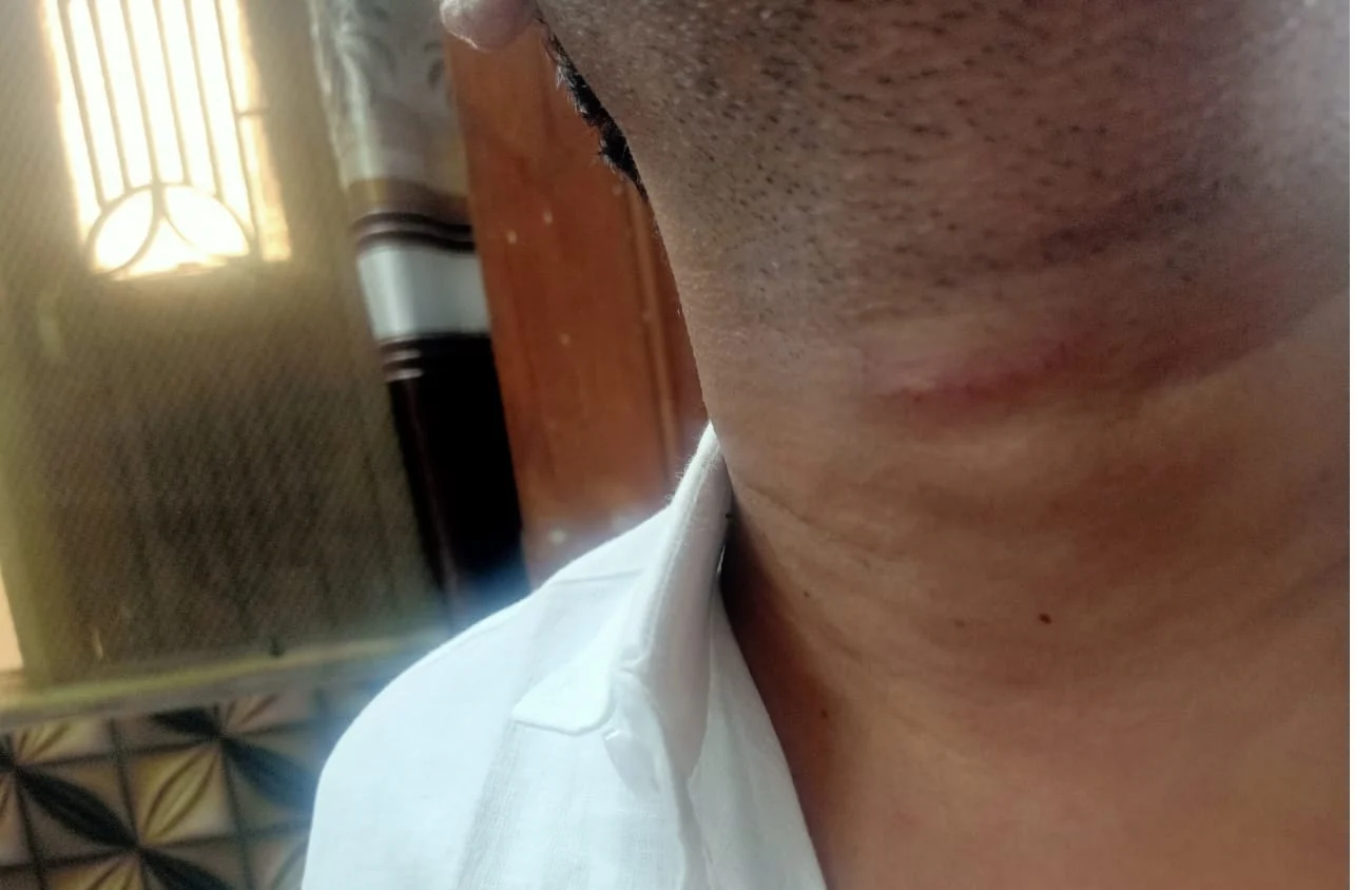 Victim sustaining injuries after being manhandled by cops