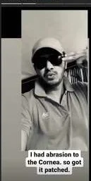 Shreyas Talpade shares selfie with bandage over the right eye, reveals he had cornea abrasion