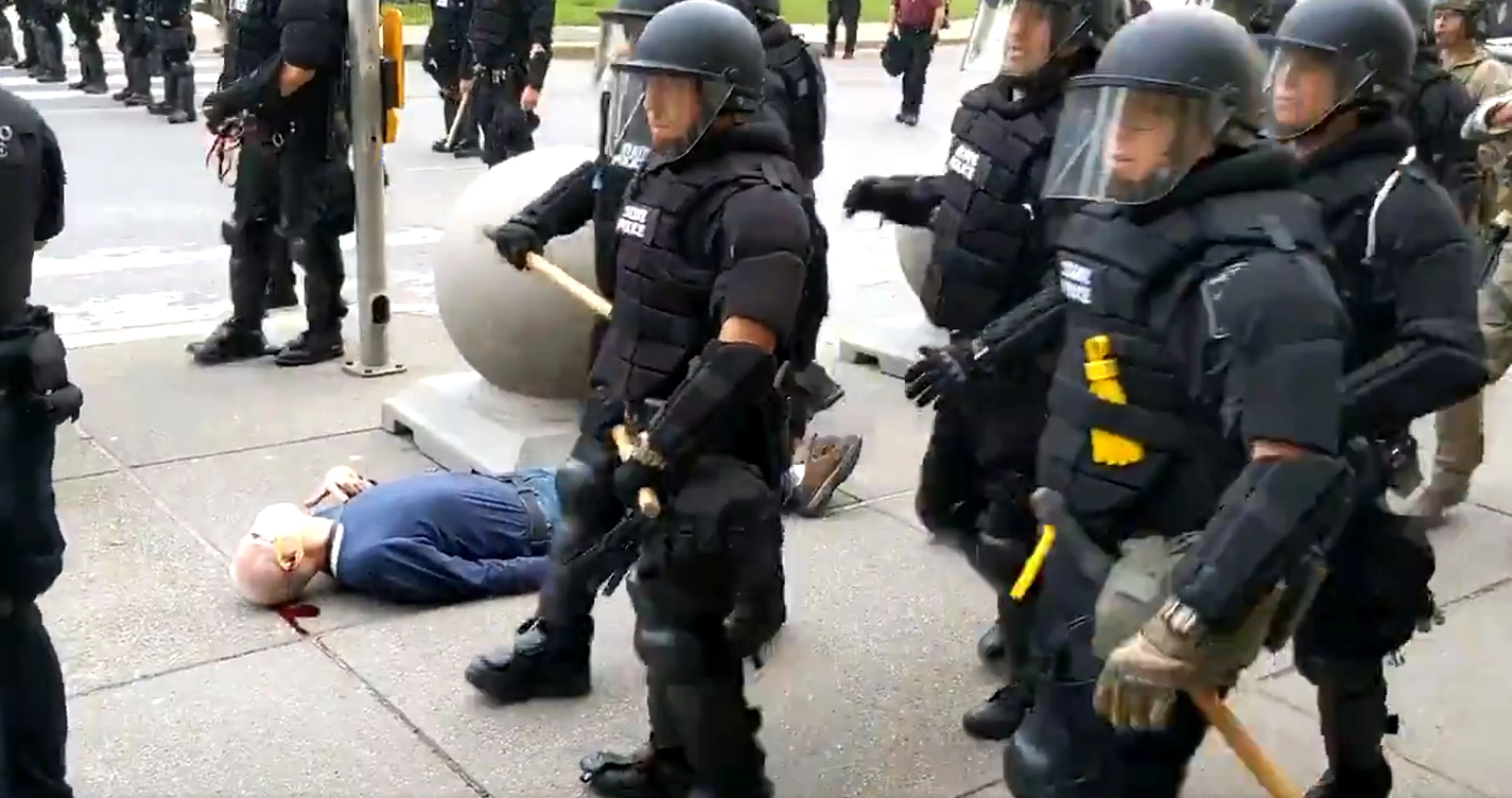 he protester was reported to be in stable but serious condition at a local hospital