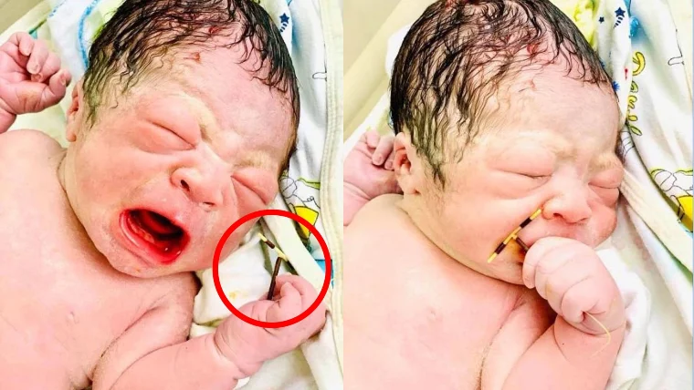 The Chosen One: Baby born holding mum's IUD