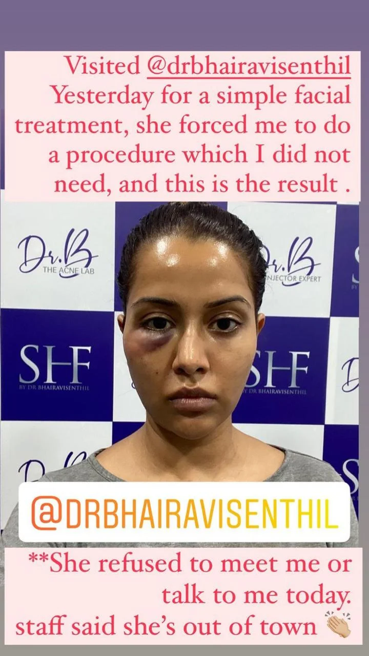 Tamil actress Raiza Wilson blasts dermatologist after treatment goes wrong, says she was 'forced'