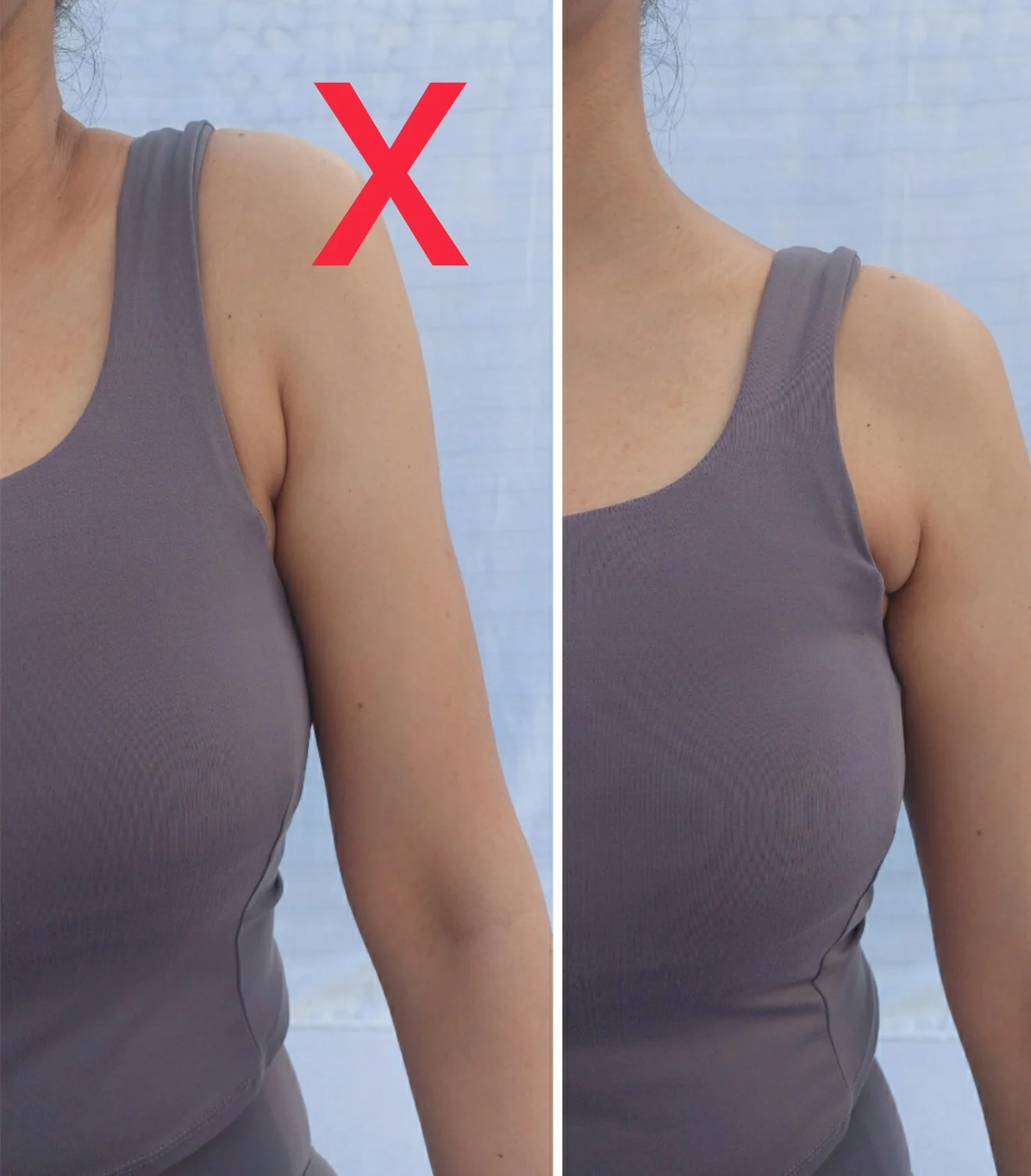 Elevated and relaxed
upper trapezius