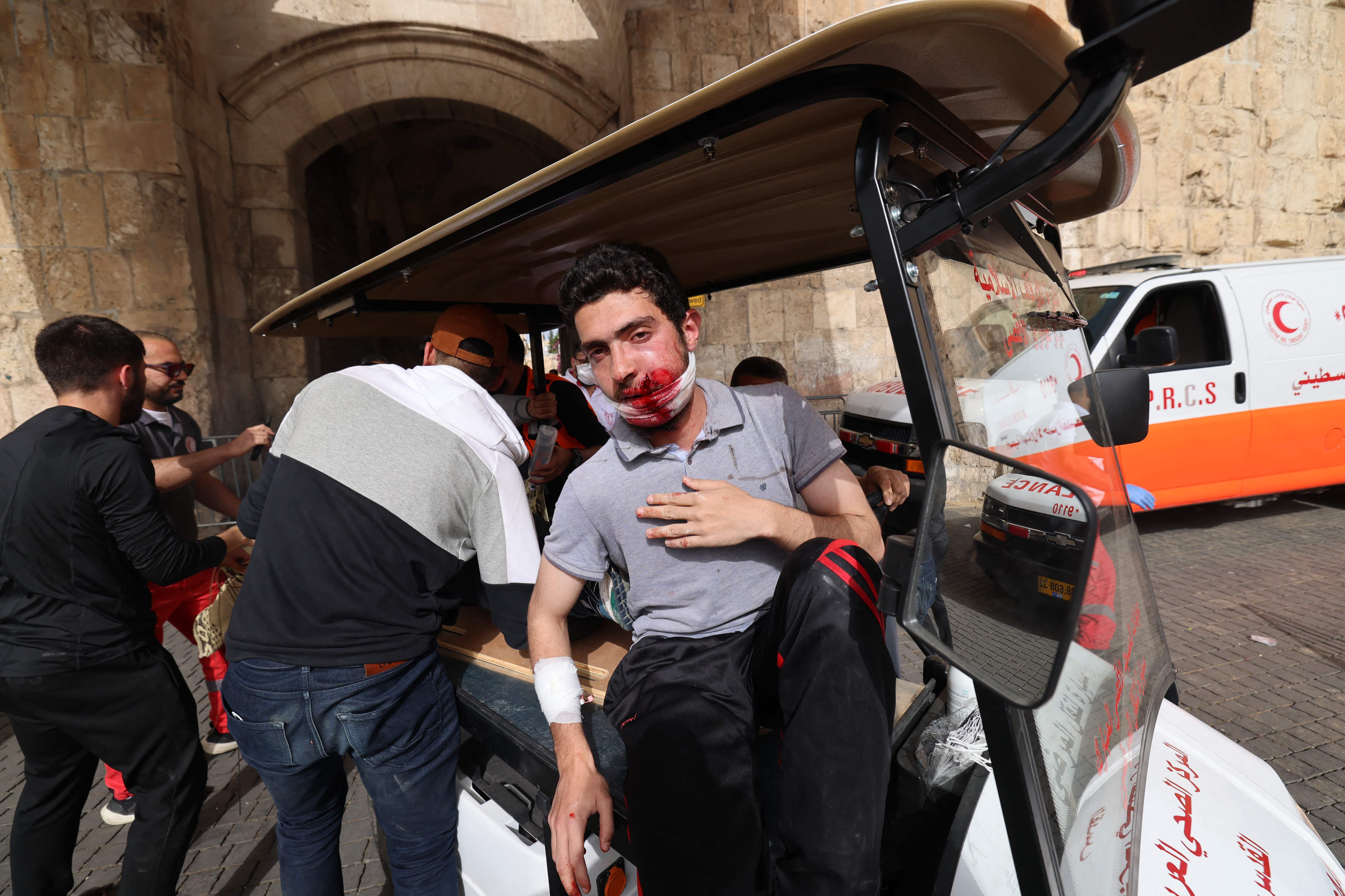 A wounded Palestinian waits to be transported by medics amid clashes with Israeli security forces at the Damascus Gate in Jerusalems Old City on May 10, 2021, ahead of a planned march to commemorate Israels takeover of Jerusalem in the 1967 Six-Day War.