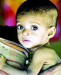 Malnutrition kills six more, after CS’ visit
