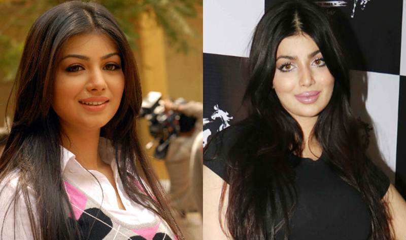 #LipsDontLie: 10 Bollywood actress who have gone under the knife for lip surgery