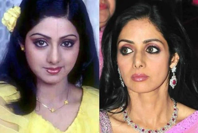 Anushka Sharma to Vaani Kapoor: 10 Bollywood heroines who went under