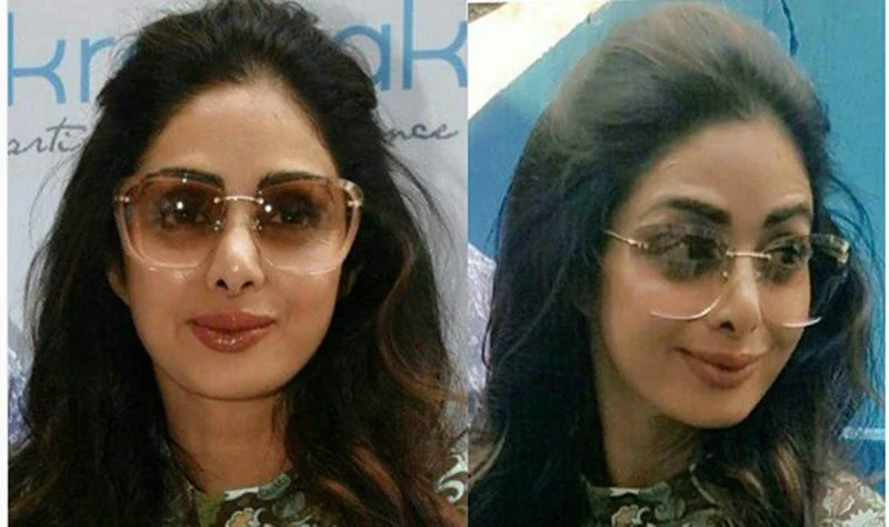 #LipsDontLie: 10 Bollywood actress who have gone under the knife for lip surgery