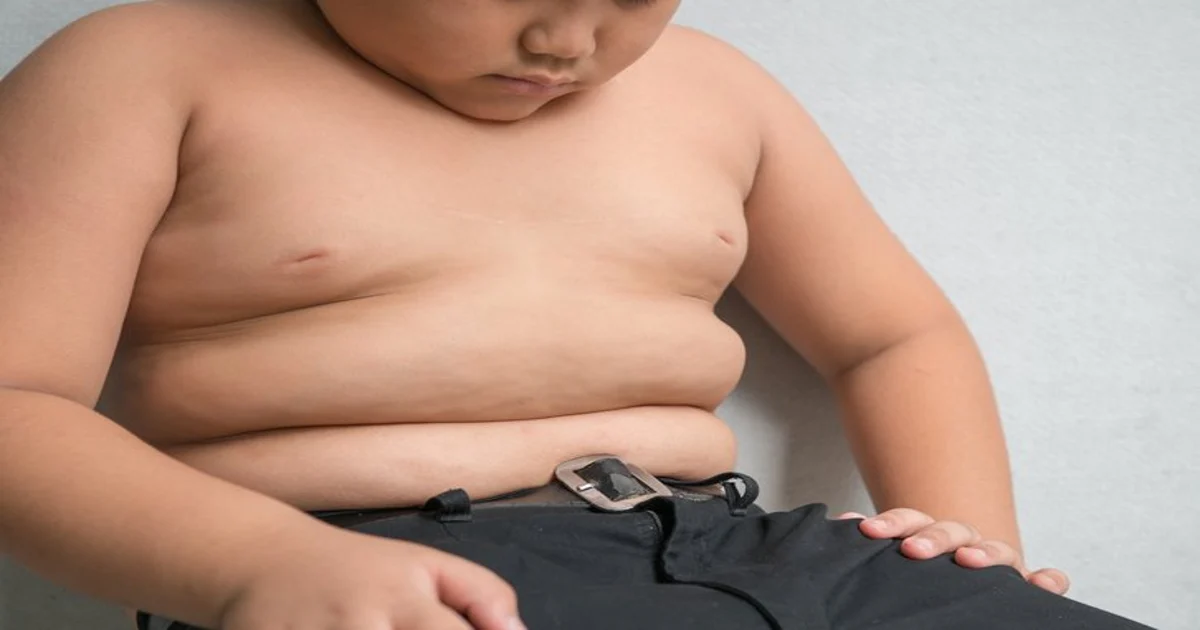 Childhood obesity may increase bladder cancer risk