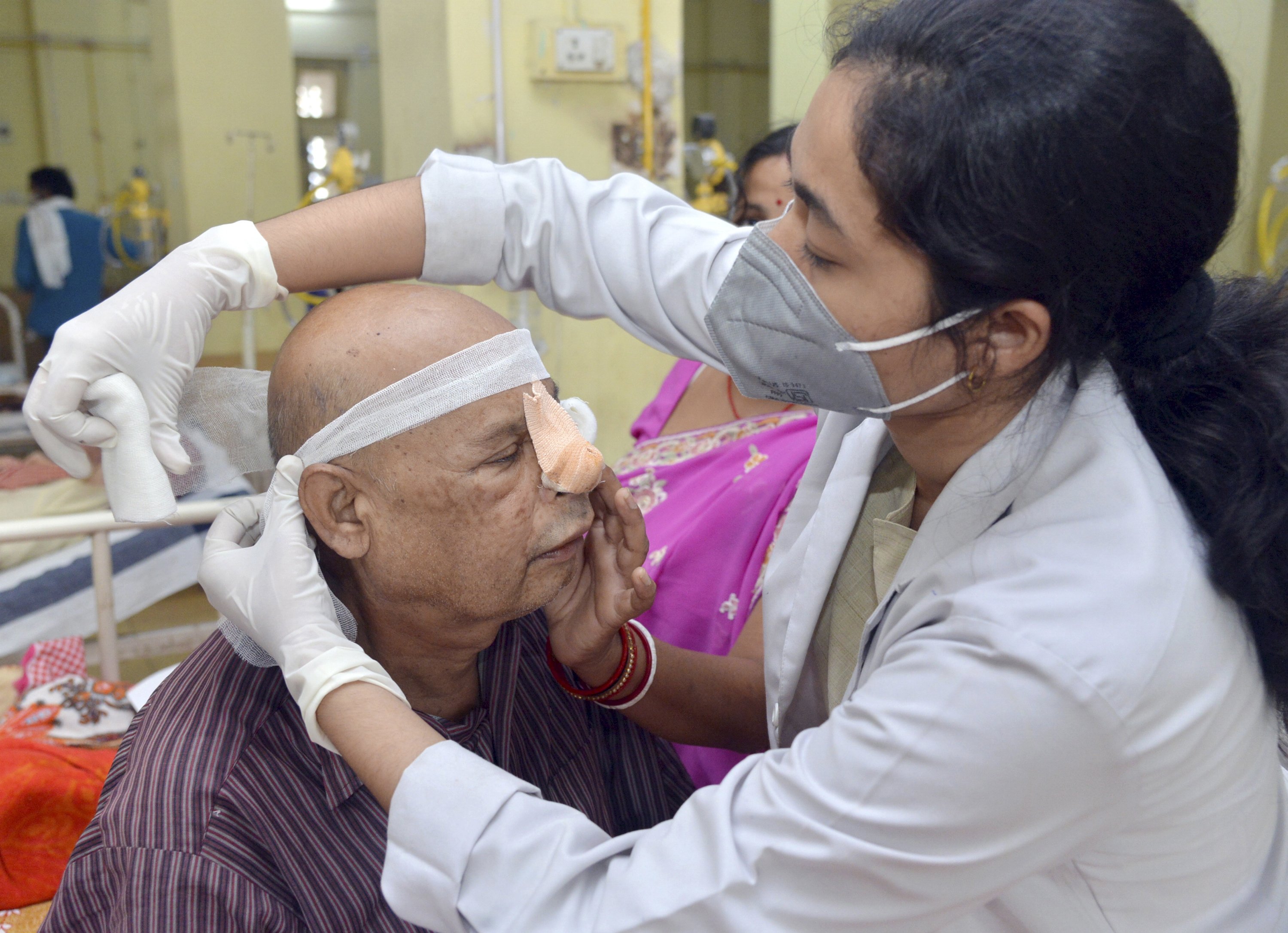 Mumbai: 987 mucormycosis cases reported in MMR so far, 294 cases detected in city - Vimarsana News