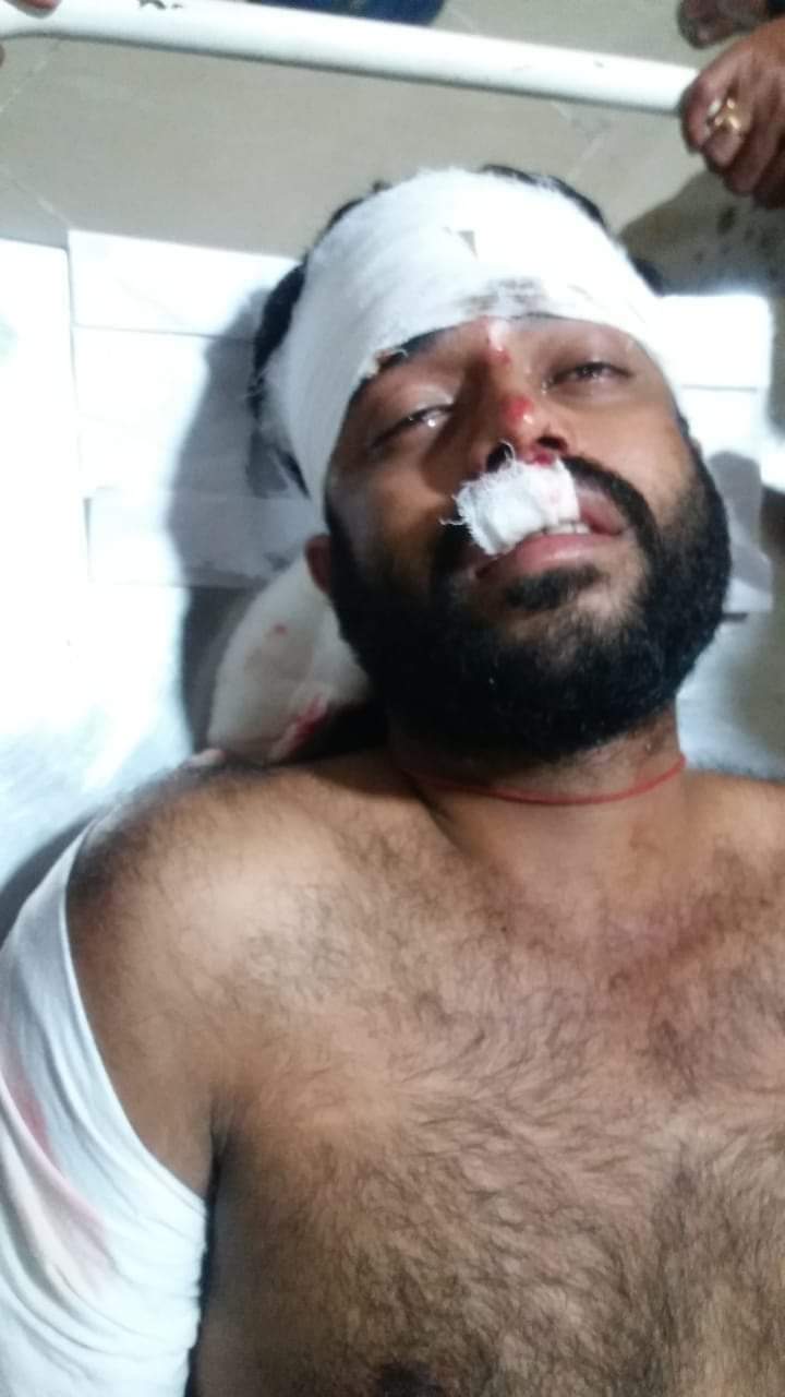 Trinamool supporter allegedly beaten up by BJP workers in Tripura, suffer injuries - Vimarsana News