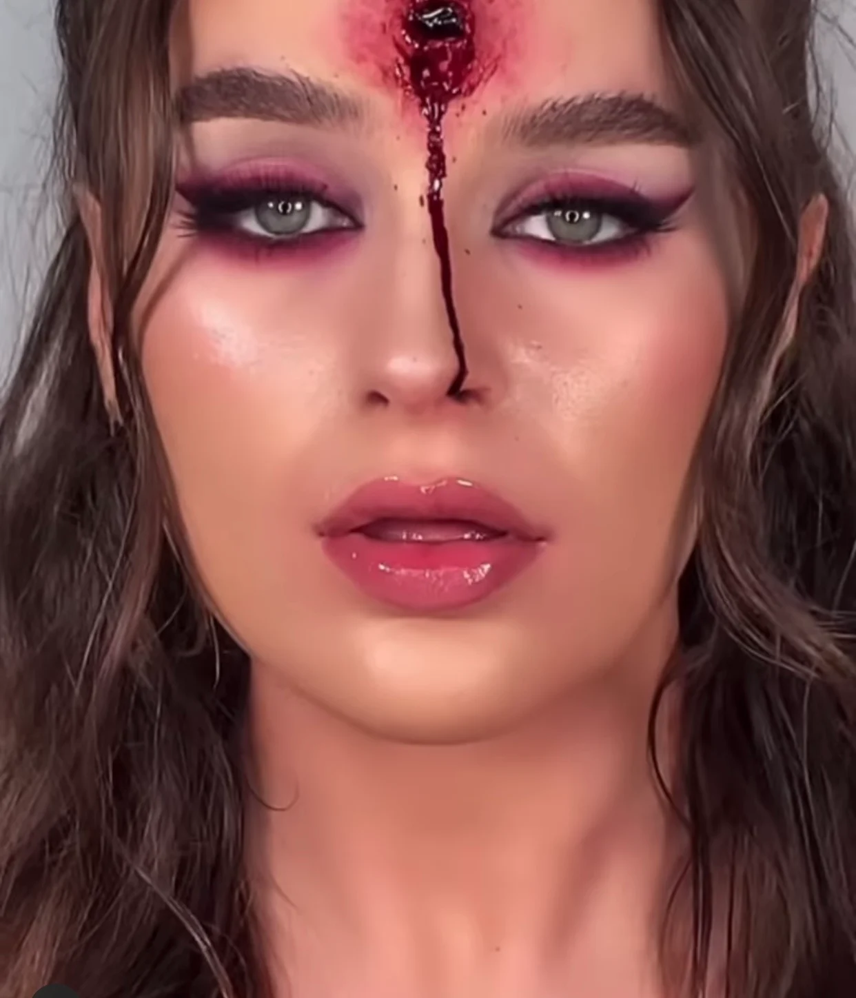 Bullet Wound