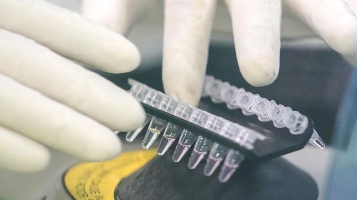 New research on developing whole-cell vaccine for urinary tract infection - Vimarsana News
