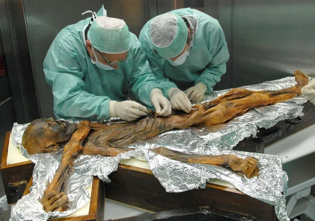 The 5,300-year-old Otzi the Iceman seemed to have been fully aware that fat represents an excellent energy source. The 5,300-year-old Otzi the Iceman seemed to have been fully aware that fat represents an excellent energy source. 
