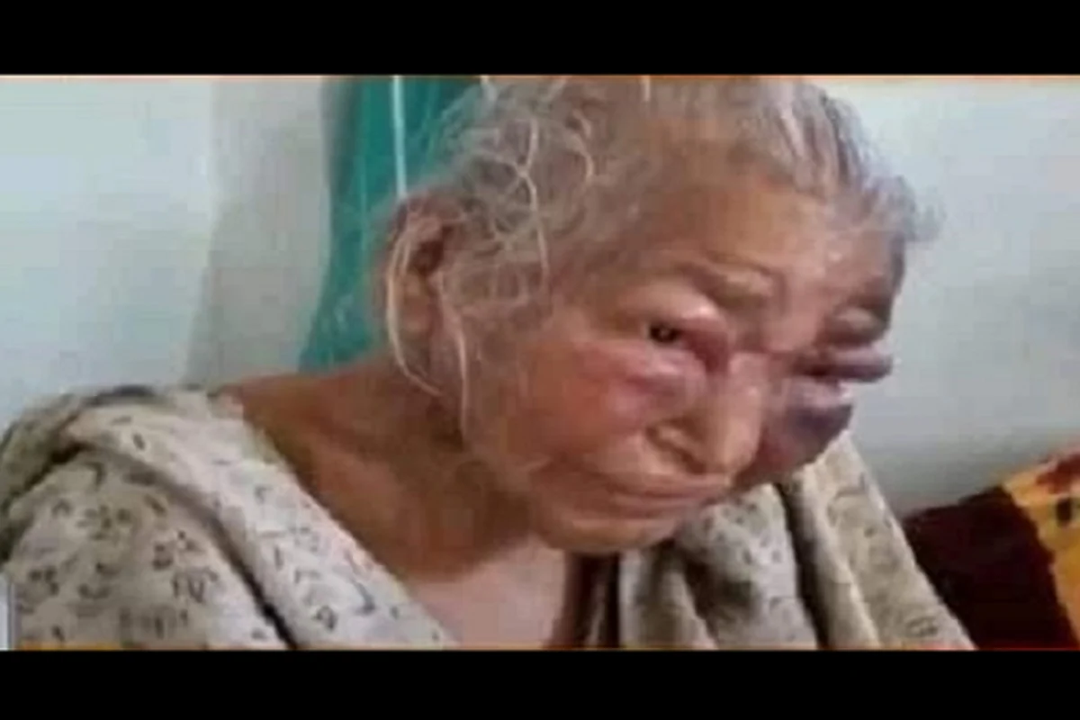 TMC Violence: 85-Year-Old Mother Of Bengal BJP Leader Passed Away After Brutal Assaulted By Trinamool Goons 3 swarajya%2F2021 02%2Fb8cf4396 e1c1 4a8b ba36 f6bd621a0912%2Fmother
