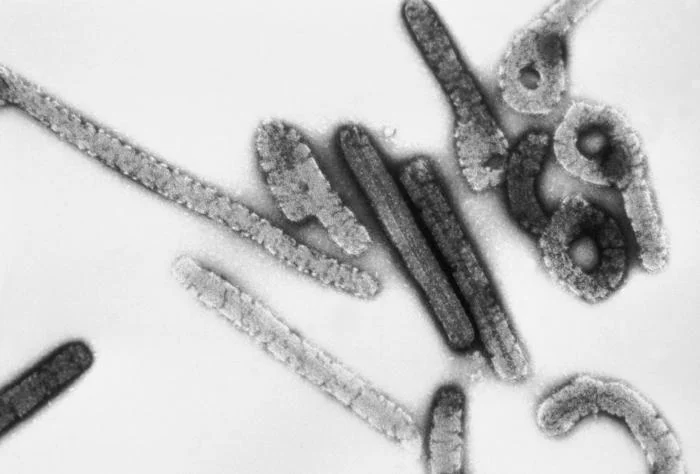 Tanzania Confirms Five Dead in Marburg Virus Outbreak