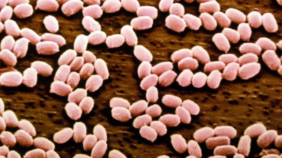 Anthrax Outbreak Prompts State of Emergency, Voronezh, Russian Federation