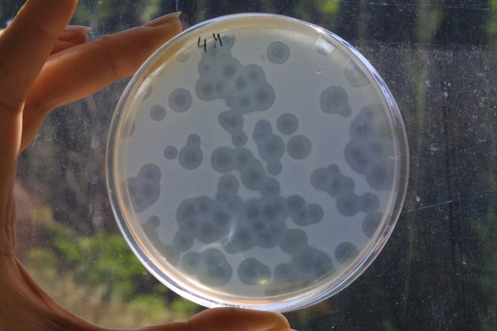 (FILES) An unidentified Georgien doctor holds 23 June 2005 at the laboratory of the Eliava Institute of Bacteriophage, Microbiology and Virology in Tbilissi the bacterium staphylococcus.