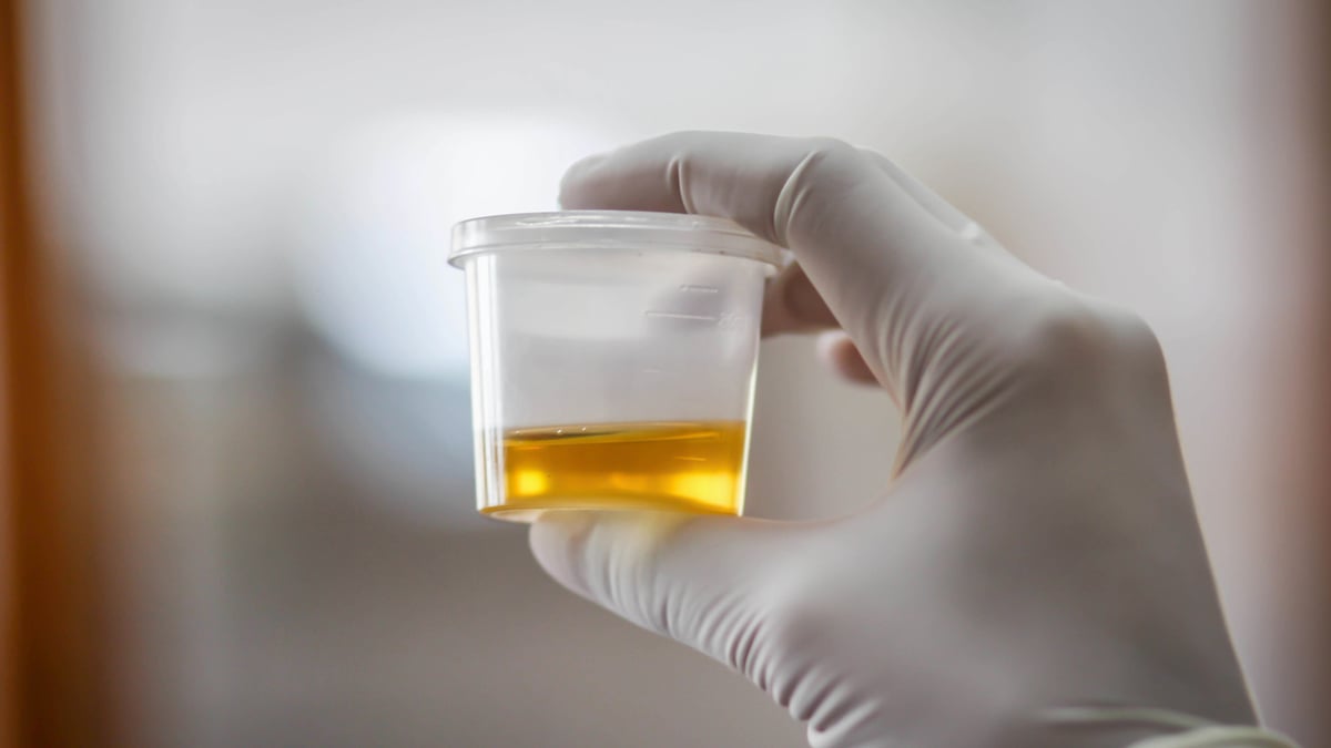 FLUID sample.