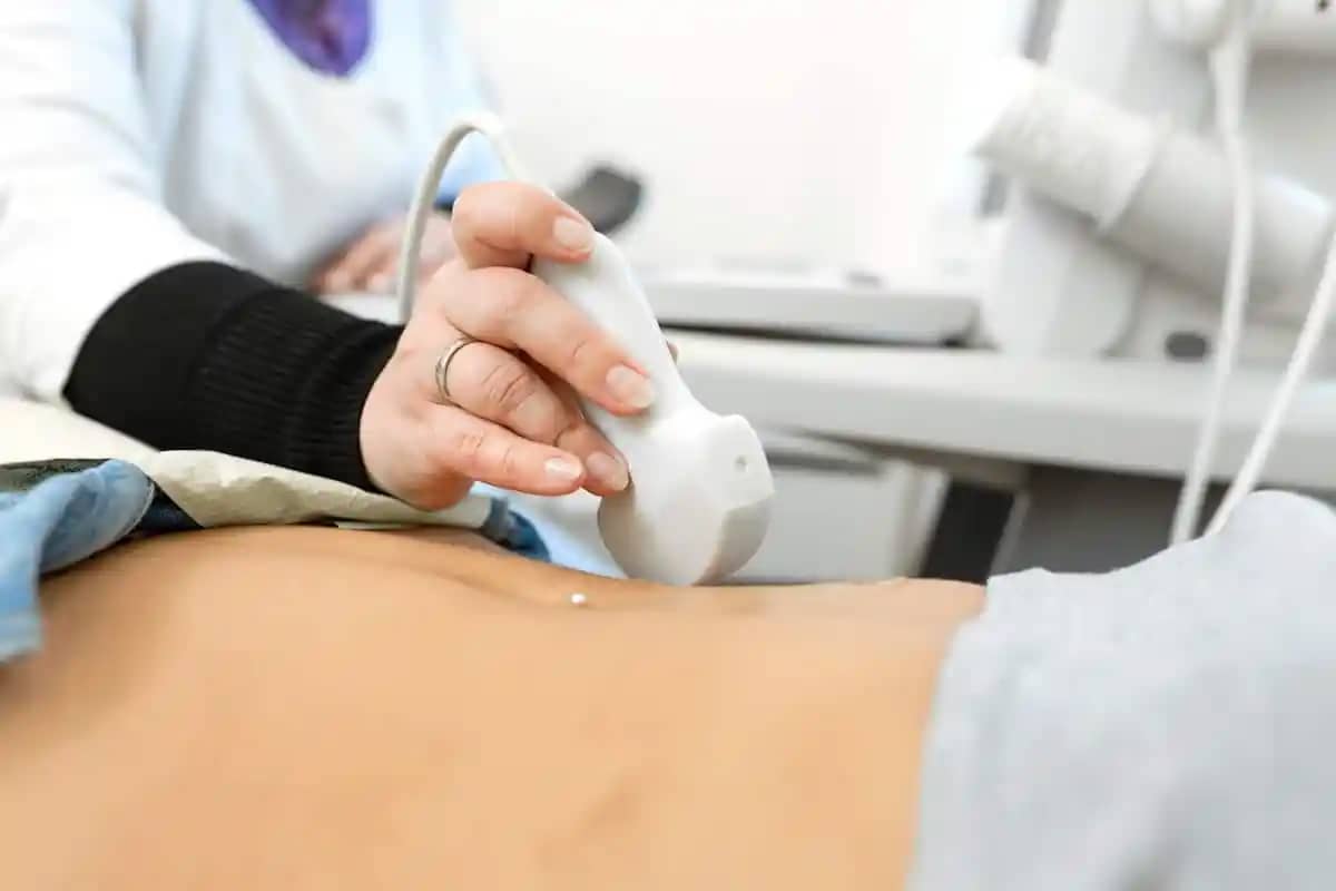 ULTRASOUND scan.