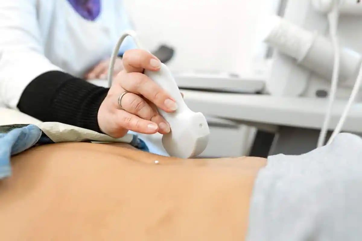 ULTRASOUND scan.