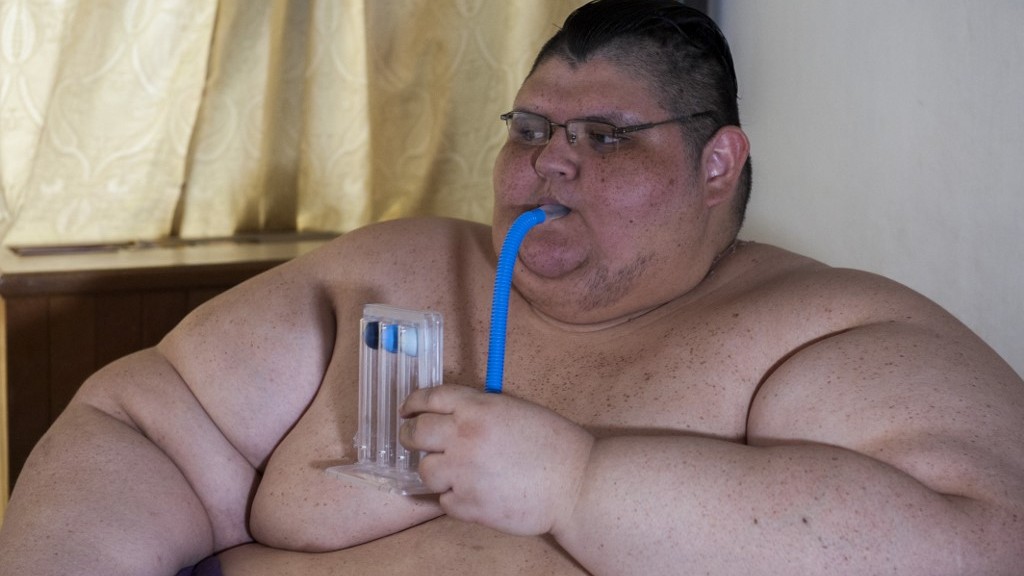 WHO: 2 in 5 individuals in Western Pacific region are obese