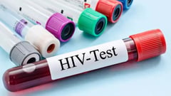 Baguio, Benguet AIDS cases high 