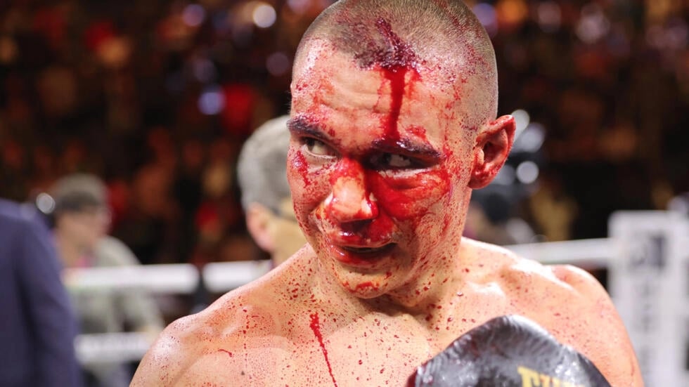 Injury cancels Tszyu-Ortiz bout