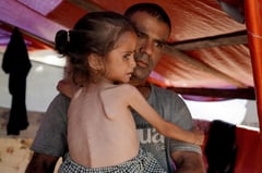 WHO says 8,000 under-5s treated for malnutrition in Gaza