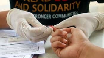 HIV