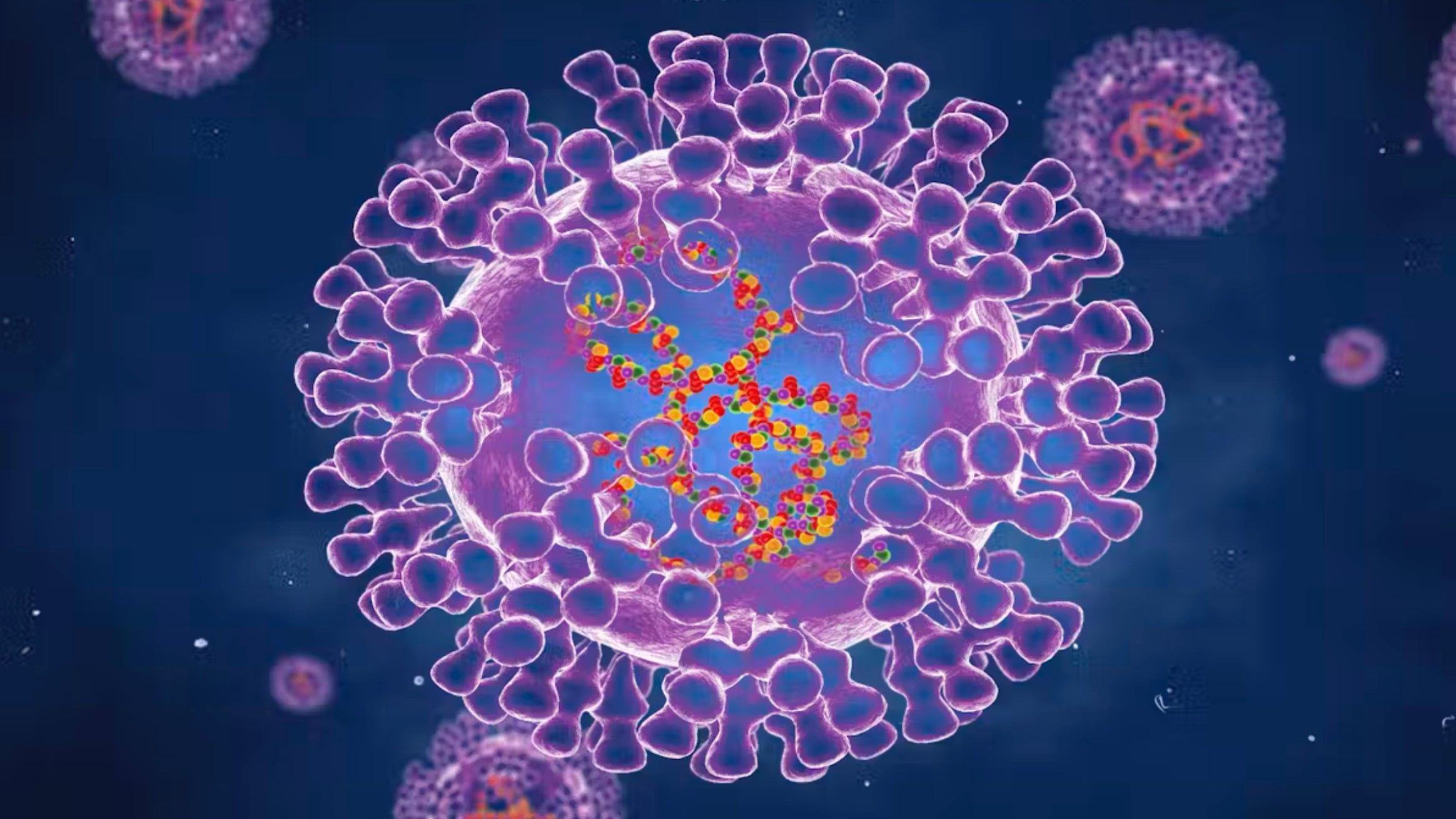 Chickenpox outbreak hits VSU