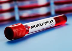 No travel history for EV’s first mpox suspect