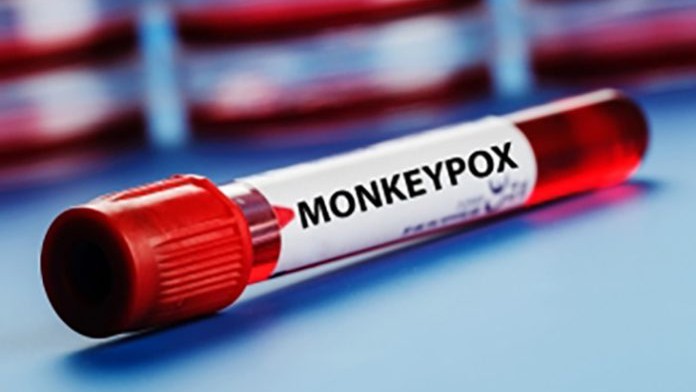No monkeypox case in MisOr town