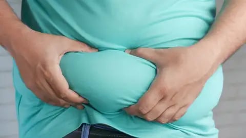 Nearly 4 of 10 Pinoys obese — expert
