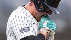 Rizzo hurts fingers