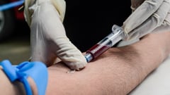 Less than half of Filipinos living with HIV undergoing treatment — WHO report