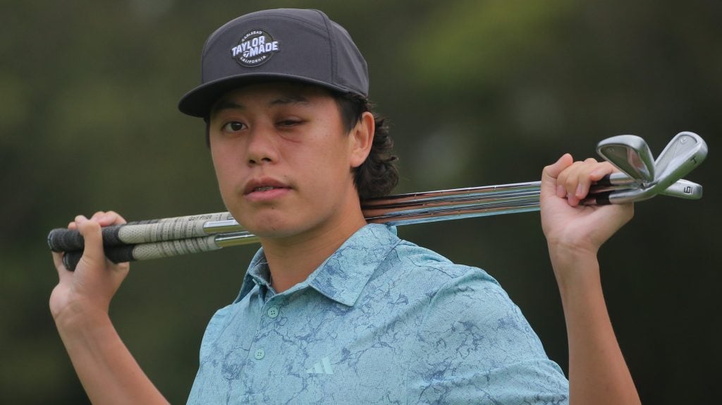 Rising golf star loses sight