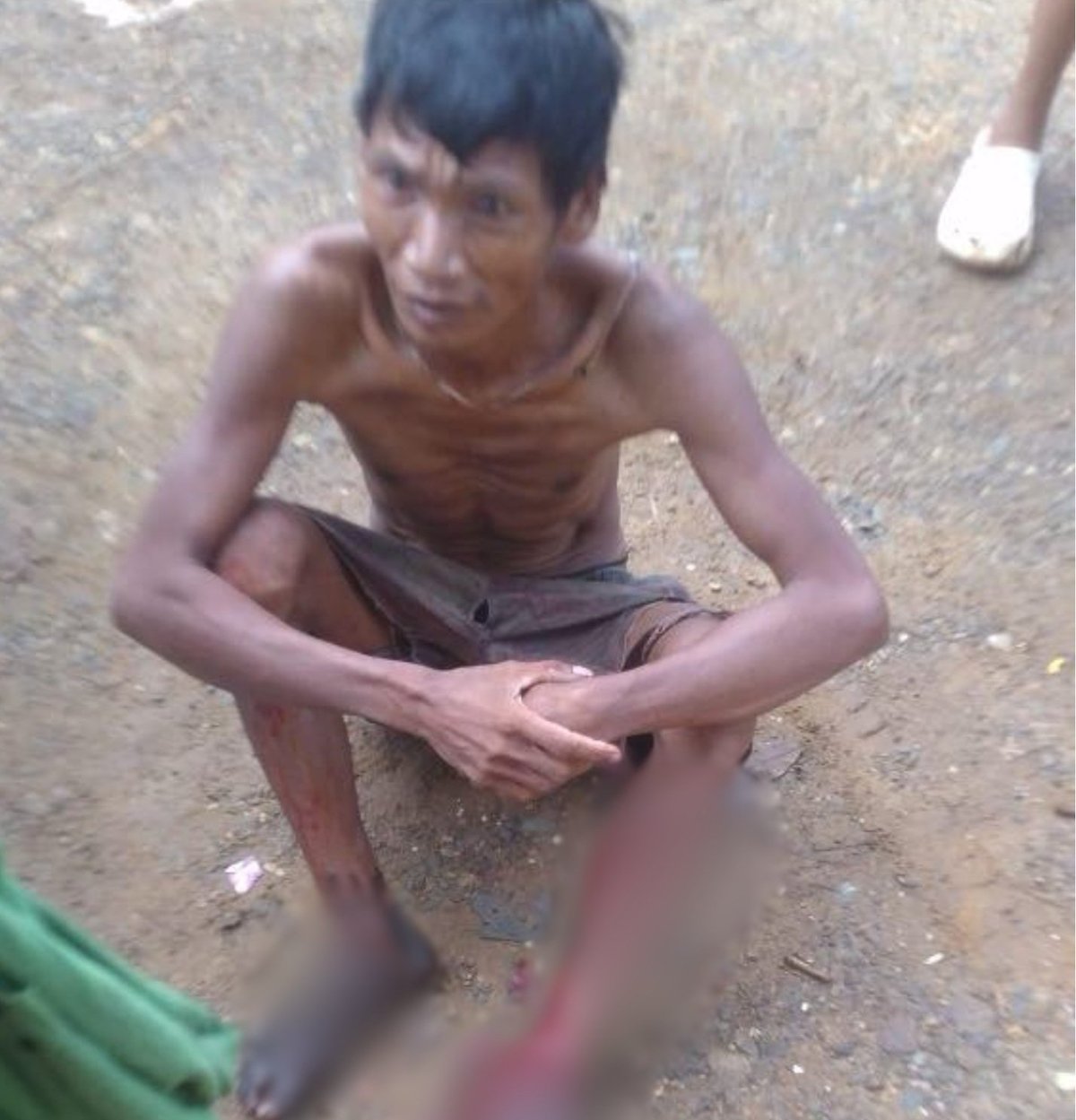 The victim of the crocodile attack on Sunday in Sitio Bukid Bukid, Barangay Rio Tuba, Bataraza, Palawan. Authorities are yet to find out his name, as he is hearing and speech impaired.